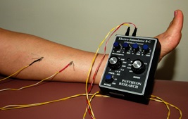 electroacupuncture_on_leg